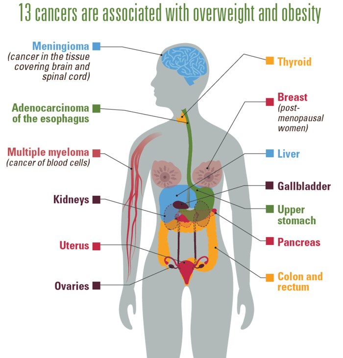 vs-1017-Obesity-Cancer-1184px-v3