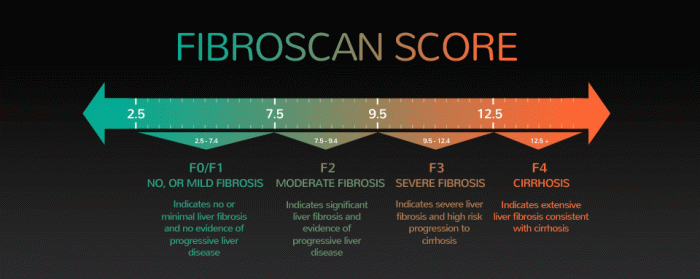 fibroscan score