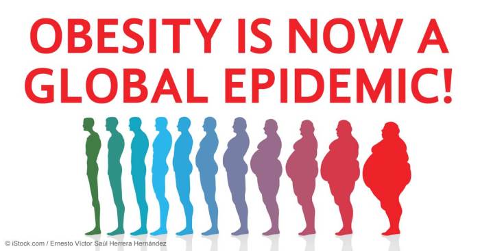 obesity-global-epidemic-fb